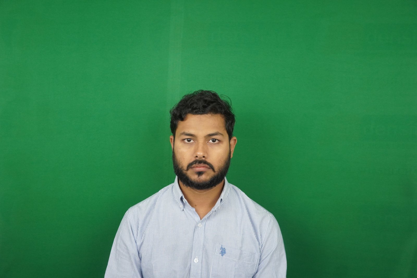Azher After Hair Transplant